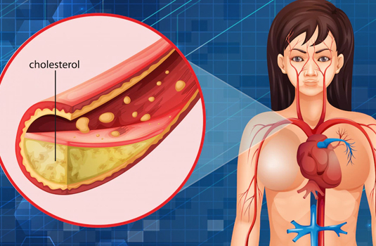 Cholesterol - information, causes of increased levels and useful tips