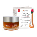 Acne Clear, Moisturizing Gel, Himalaya, 50 ml